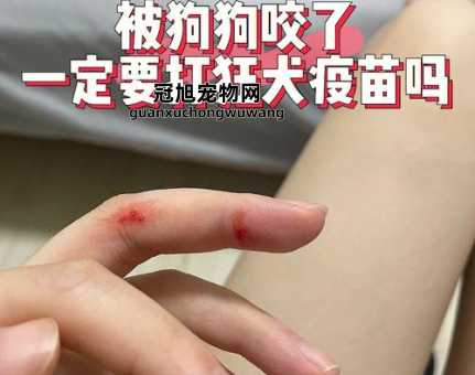 和狗狗玩后感觉自己有伤口(要不要赶紧去打狂犬疫苗)