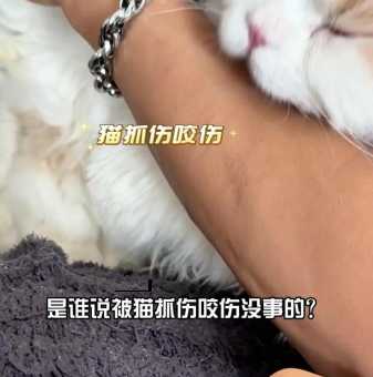 被猫咬了把血挤出来没事吧( 万一是狂犬病怎么办)
