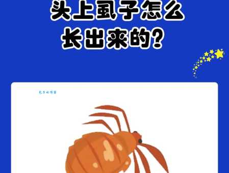 孩子头上长虱子怎么办？教你轻松去除虱子的方法！
