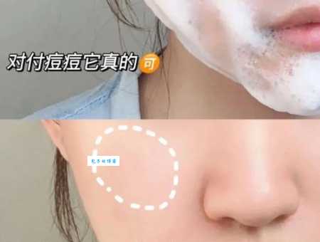 雅漾免洗洗面奶怎么样？懒人福音真实体验！