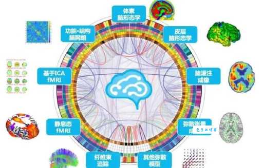 既视感是什么意思 科学解释这种神秘现象