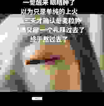 听说挑针打眼很流行？到底是什么意思呢？