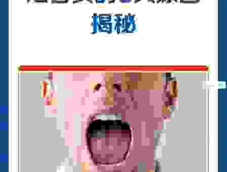 终于知道缄舌闭口的意思了！原来是这么回事！