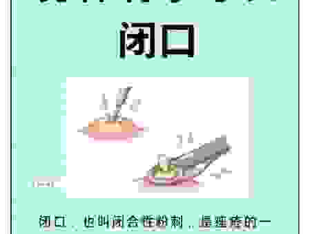 缄舌闭口什么意思？学了你就明白，原来这么简单！